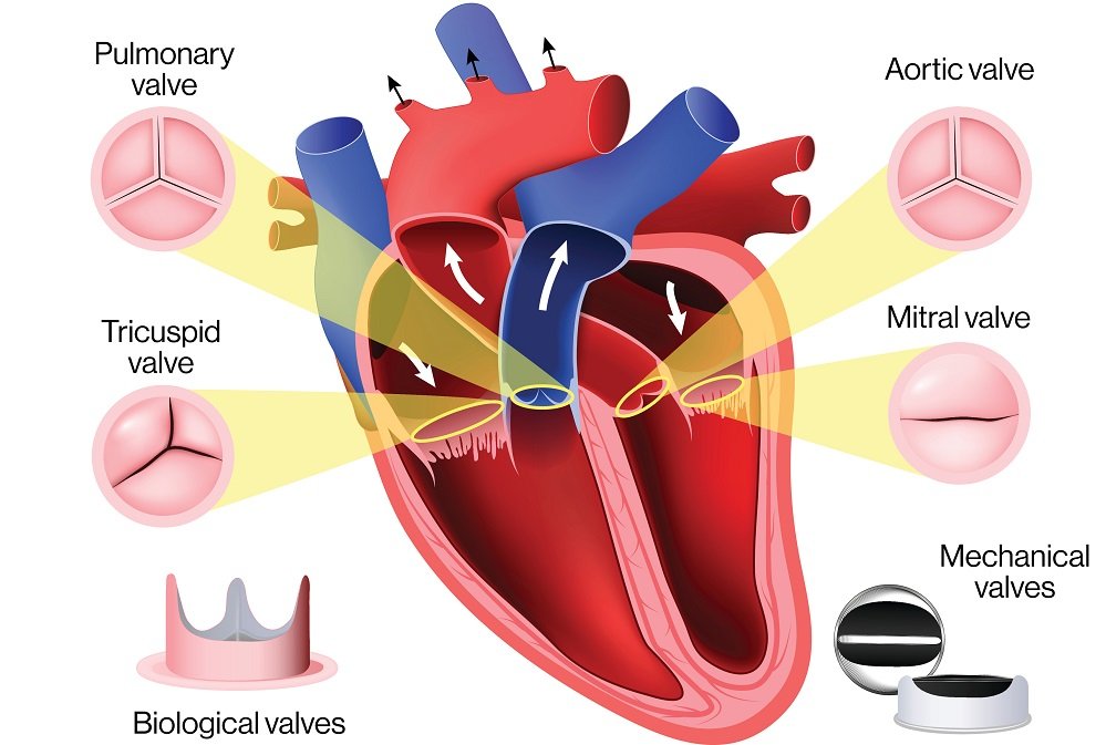 Before-And-After Mitral Valve Repair Surgery Pictures