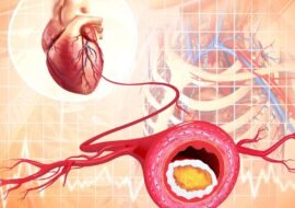 How To Reduce The Risk Factors Of Cardiovascular Disease! 1 How To Reduce The Risk Factors Of Cardiovascular Disease! 1